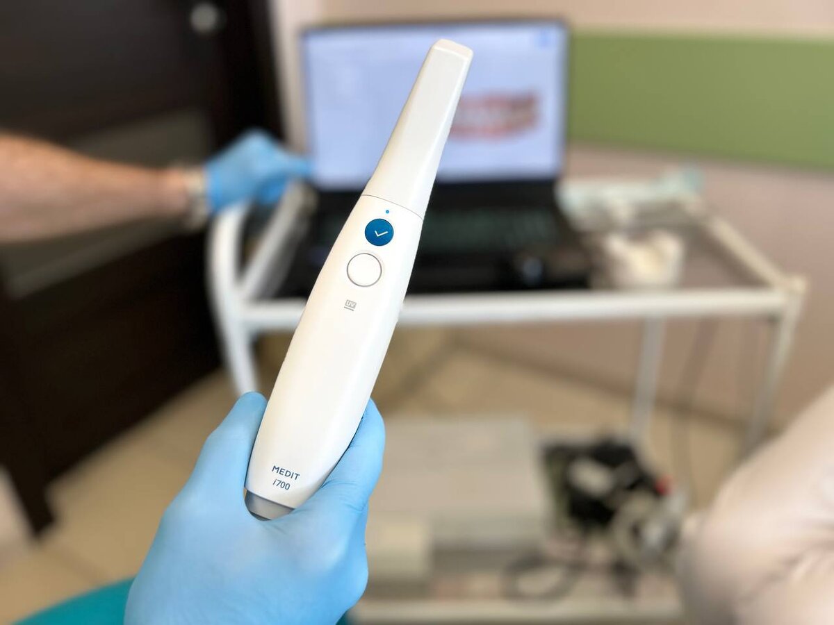 Фото сети клиник "Фактор Улыбки", на фото сканер Medit