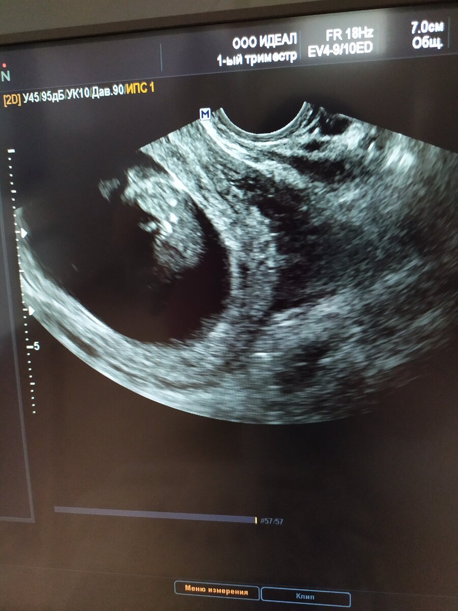 Здесь недель 10