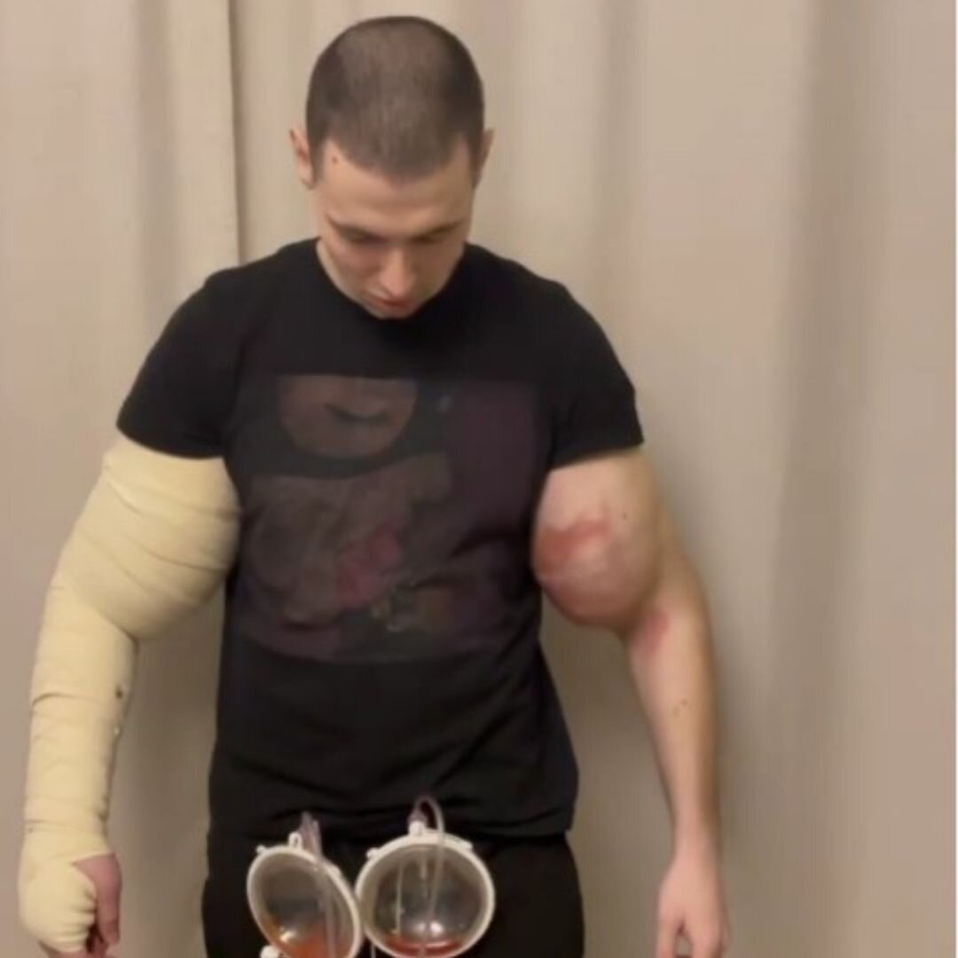 Руки-Базуки 3 года спустя. Показываю что с ним стало, как выглядит и ...