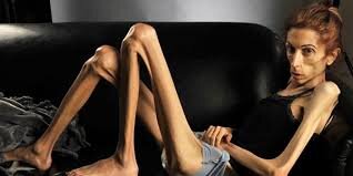 Зачем к врачу, уж не завидуешь ли ты мне??