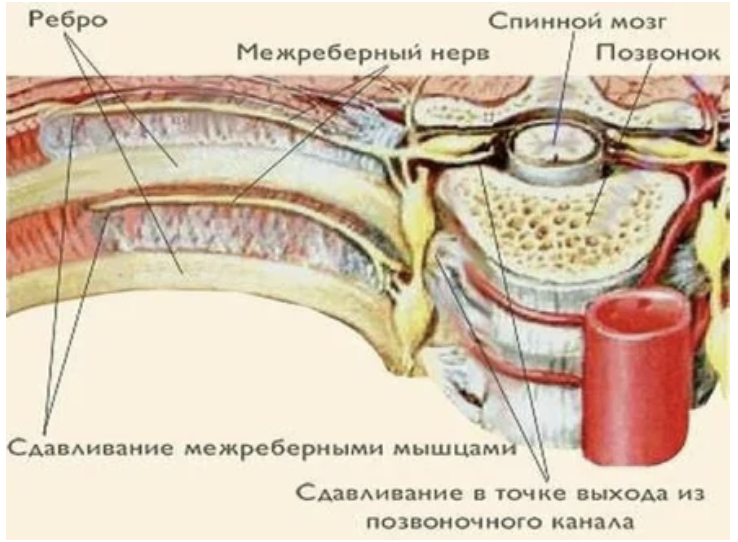 Причины боли в грудной клетке: диагностика, лечение