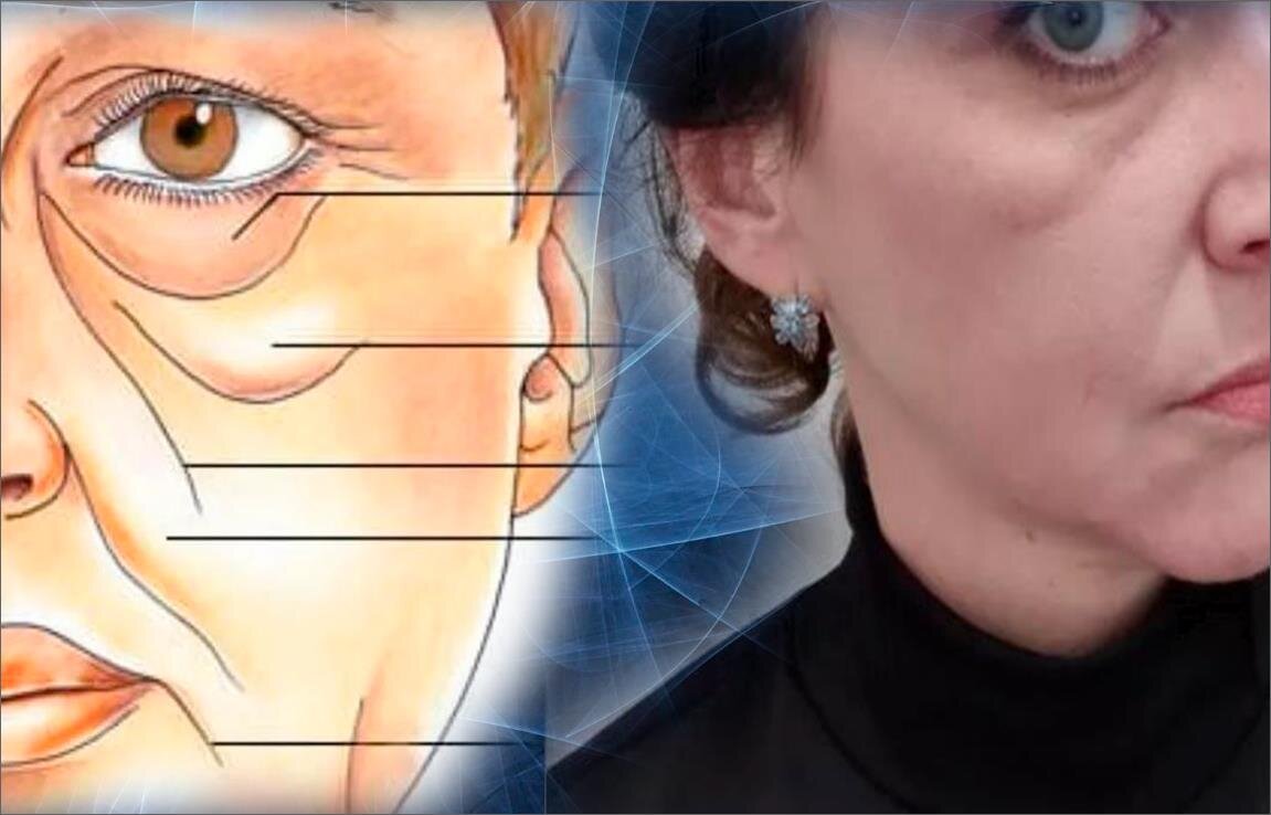 Зона суфы на лице