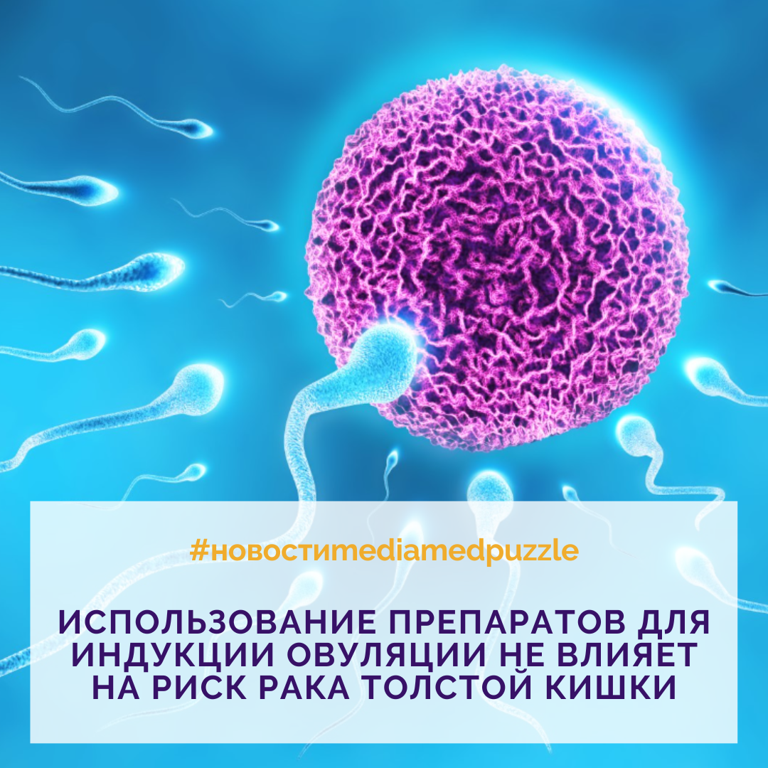 Использование препаратов для индукции овуляции не влияет на риск рака  толстой кишки | Media Puzzle | Дзен