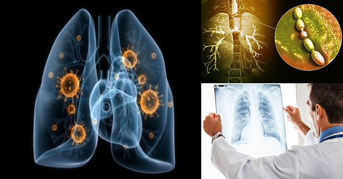 Toată lumea la un moment sau altul experimentează dureri de spate.-10