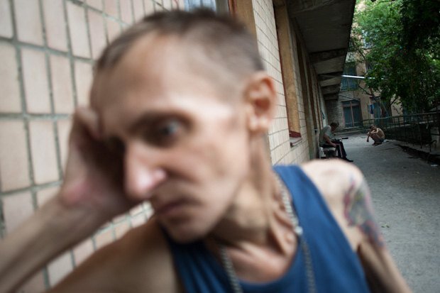 Я не могу ручаться на 100%, но на фото человек очень похож на "туберкулёзника". Фото сделано Максимом Дондюком (Украина), позаимствовано с сайта lb.ua