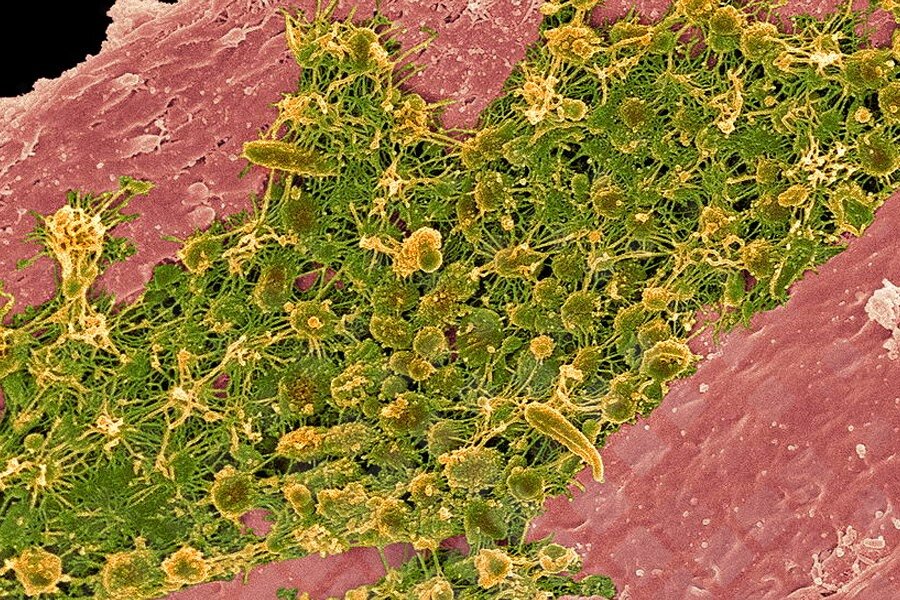Зубной налет на 70% может состоять из тысяч аэробных и анаэробных микроорганизмов, бактерий, грибков. Фото: Яндекс.Картинки.