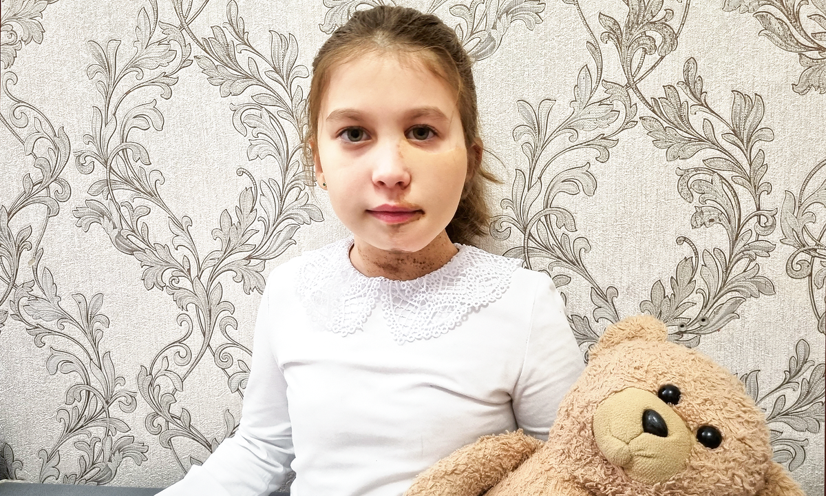 Диана Брагина, подопечная фонда "Алёша"