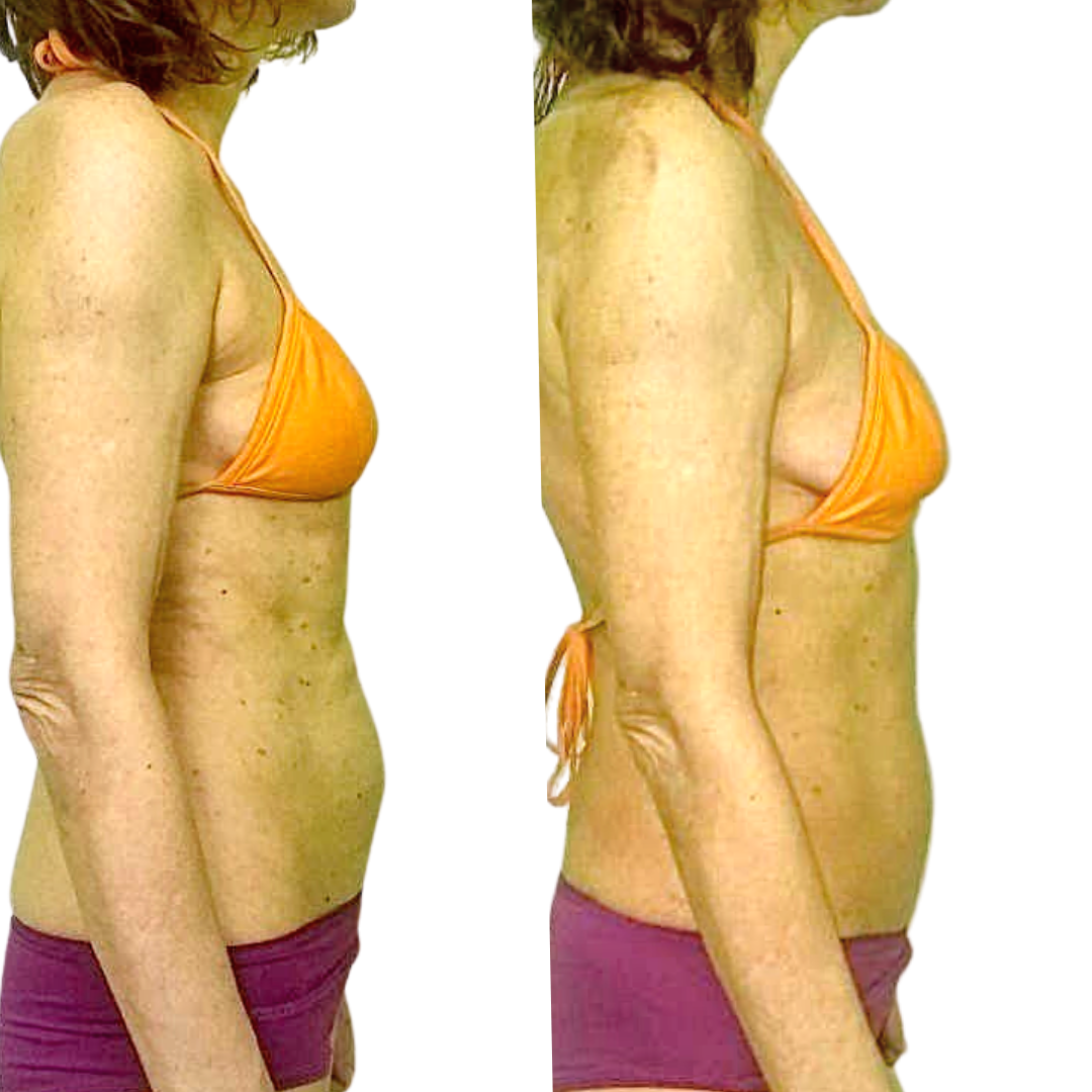 Процедуры на аппарате Налар