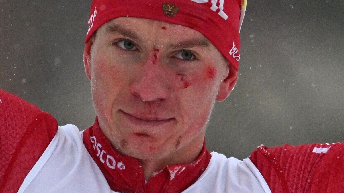    Лыжные гонки. V этап Кубка России. Мужчины. Спринт© РИА Новости / Павел Бедняков