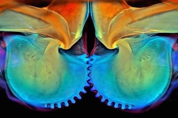 Сустав цикады