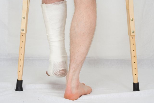    Сможет ли человек ходить после ампутации пальцев ног?