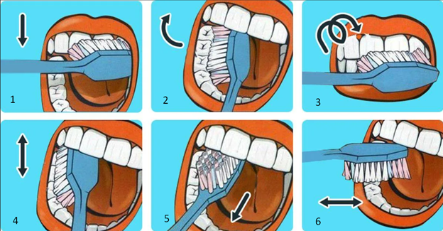 Выметающие (1,2,5), круговые (3)  и поступательные движения чистки зубов (4,6) 