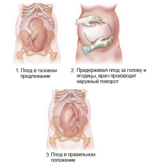 Секс во время беременности и после родов?