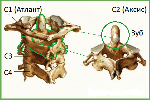 Зуб в шейном отделе