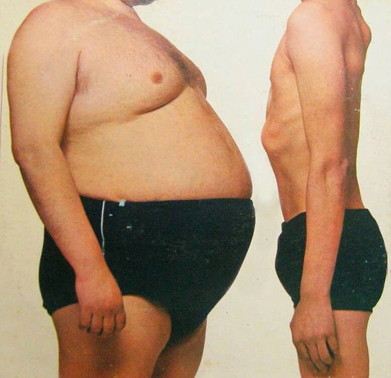 У меня было так)