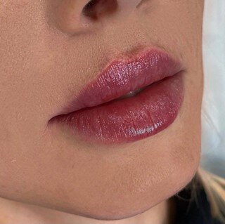 Сочные губы после контурной пластики