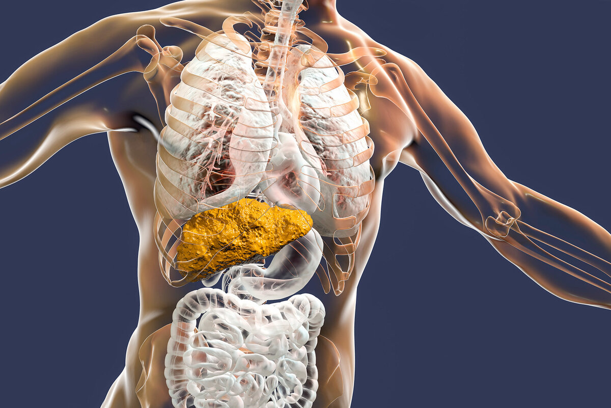     Может ли цирроз печени возникать у людей, которые вообще не пьют алкоголь?