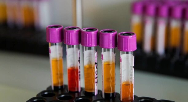 фото: https://www.vedomosti.ru/