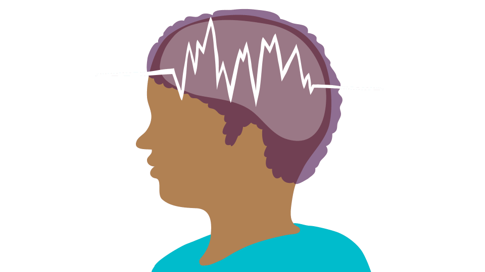  Судорожные припадки возникают из-за избыточных электрических разрядов в группе клеток головного мозга. Источник: Яндекс.Картинки