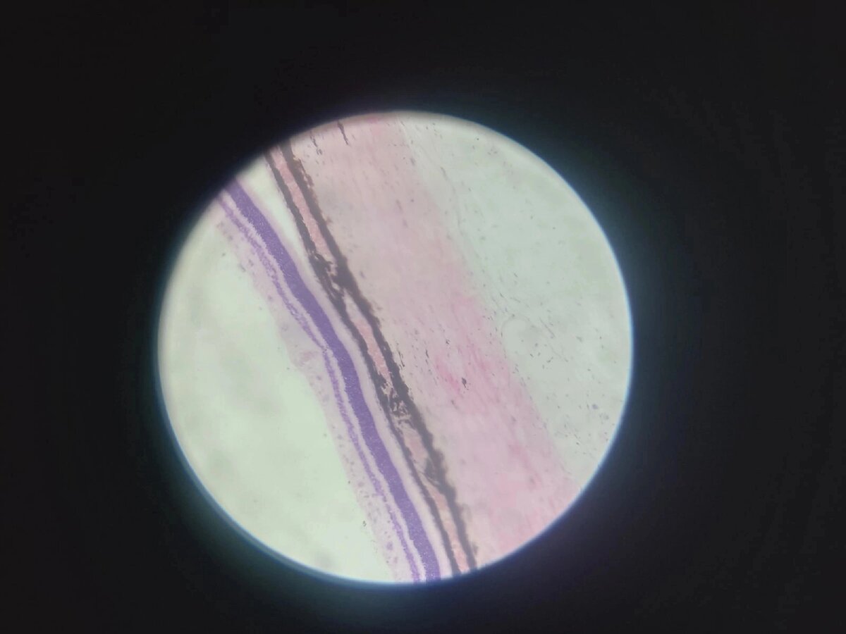 Задняя стенка глаза( прикиньте, там 10 слоев)