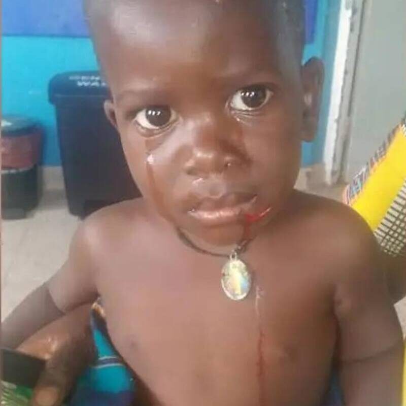 Facebook
Игу Пола срочно доставили в ближайшую больницу для лечения, а также сделали прививку от бешенства, после чего он полностью выздоровел.
