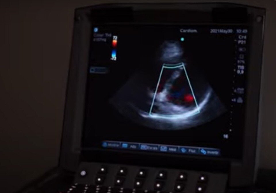     Если ожог болит – это поверхностный ожог. Фото: кадр видео ctv.by