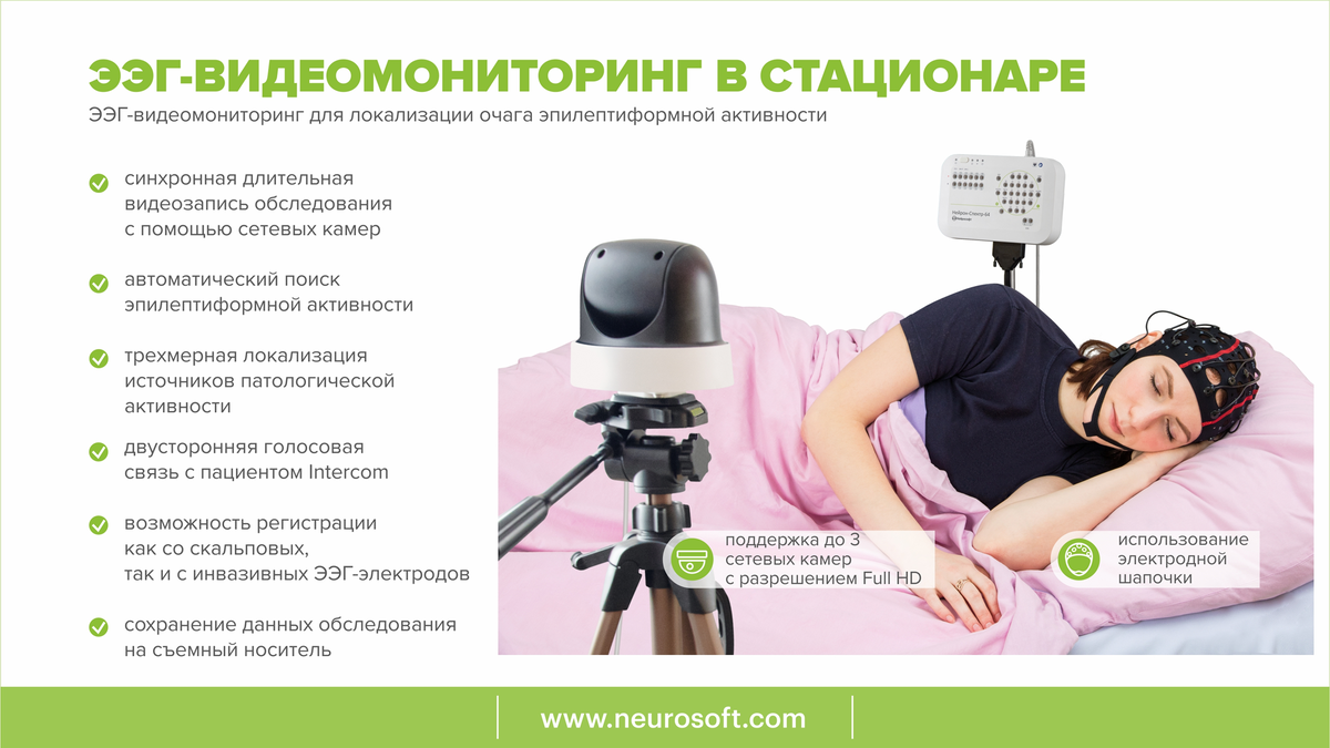 Ээг видеомониторинг сна. Электроэнцефалограф мицар-ээг. Видеомониторинг ээг ребенку. Ээг видеомониторинг сна. Ночной видео ээг мониторинг.