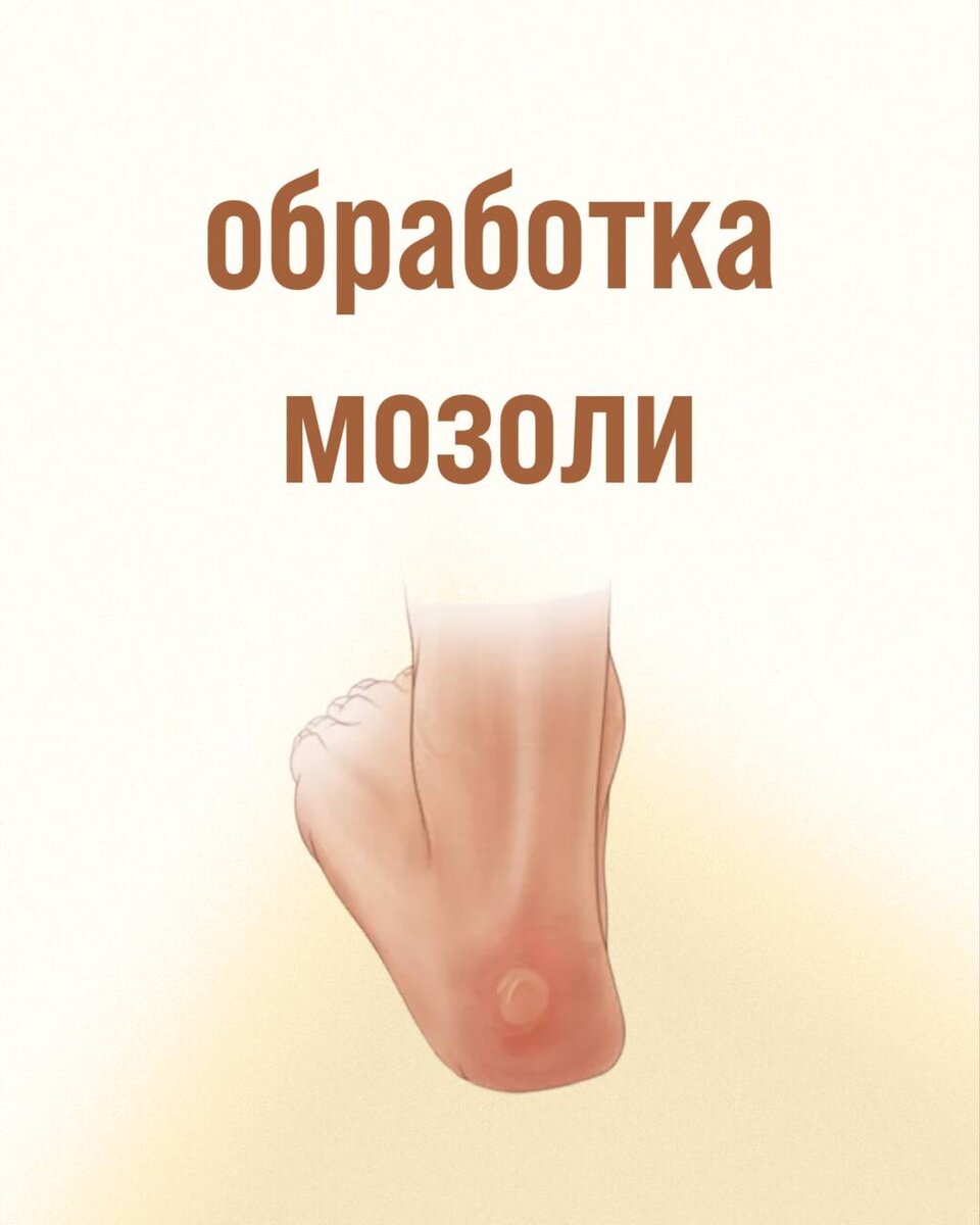 Сегодня специалисты клиники подологии хотят рассказать вам об одной из услуг, предлагаемых в нашей организации – это удаление мозолей и бородавок с помощью азотной кислоты.