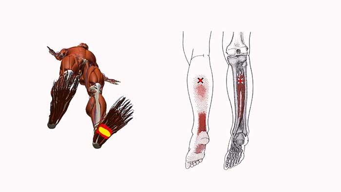 Триггерные точки стопы. Триггерные точки на подошве стопы. Триггерные точки на стопе славйога. Триггерные точки мышц стопы и голени.