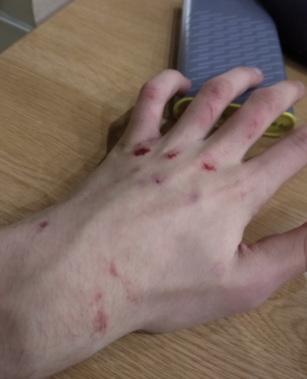 Рука друга.