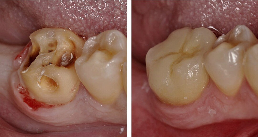 Фото: «УстаДент»