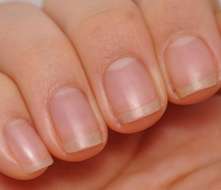 Лунки на ногтях. vk.com