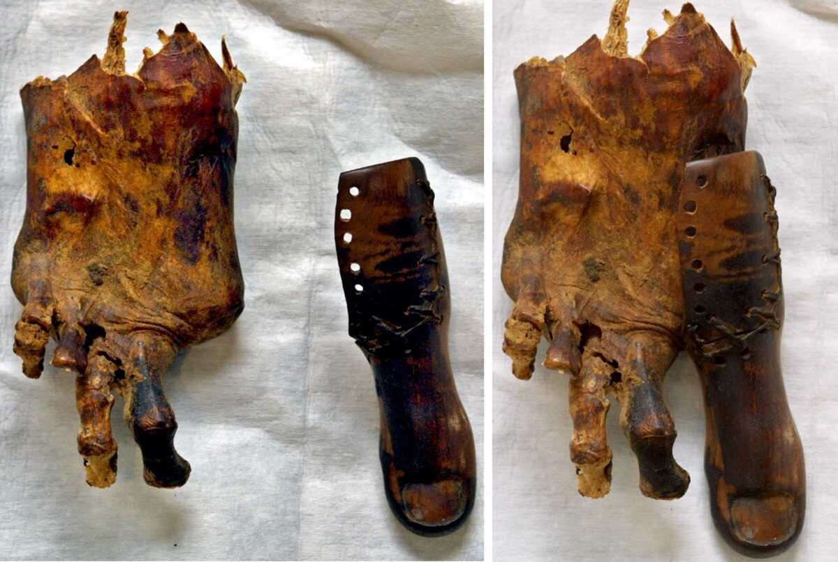 Крепление протеза на ноге мумии. По мнению учёных человек, носивший этот протез лишился большого пальца ноги вследствие гангрены, развившейся из-за диабета. Источник изображения: Egyptian Museum, Cairoона 