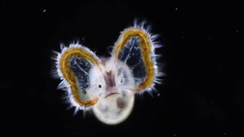 Не переживай, все мы в подростковом возрасте выглядели так себе... 