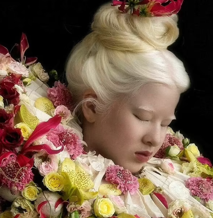 Родители оставили Сюэли в детском доме, испугавшись ее странной внешности