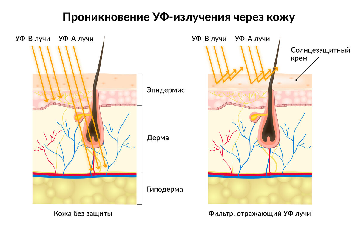 Под действием ультрафиолетовых лучей в коже образуется. Влияние УФ лучей на кожу. Воздействие УФ на кожу. Влияние ультрафиолета на кожу. Влияние ультрафиолетовых лучей на кожу