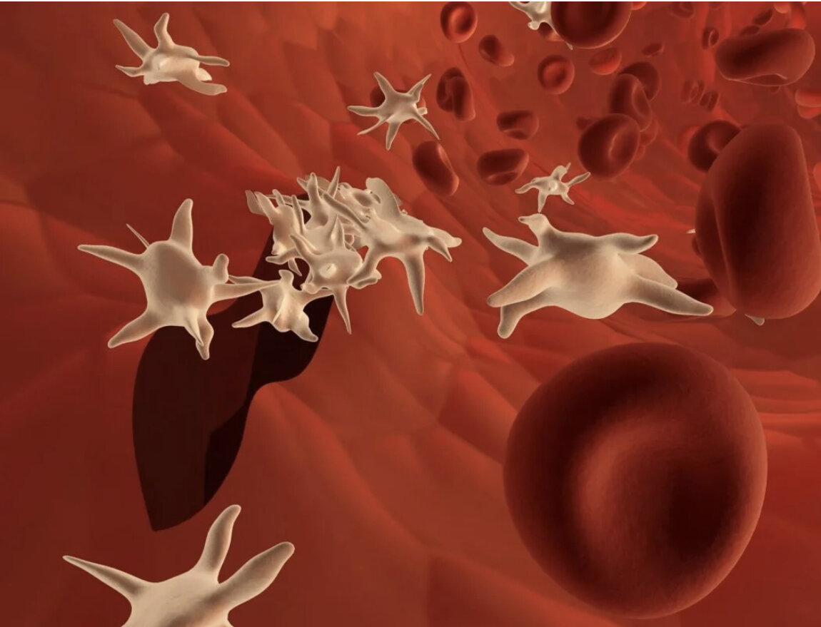 Так выглядят активированные тромбоциты-они имеют выросты, похожие на щупальца. Изображение с сайта: https://oonkologii.ru/ponizhennye-trombotsity-posle-himioterapii/