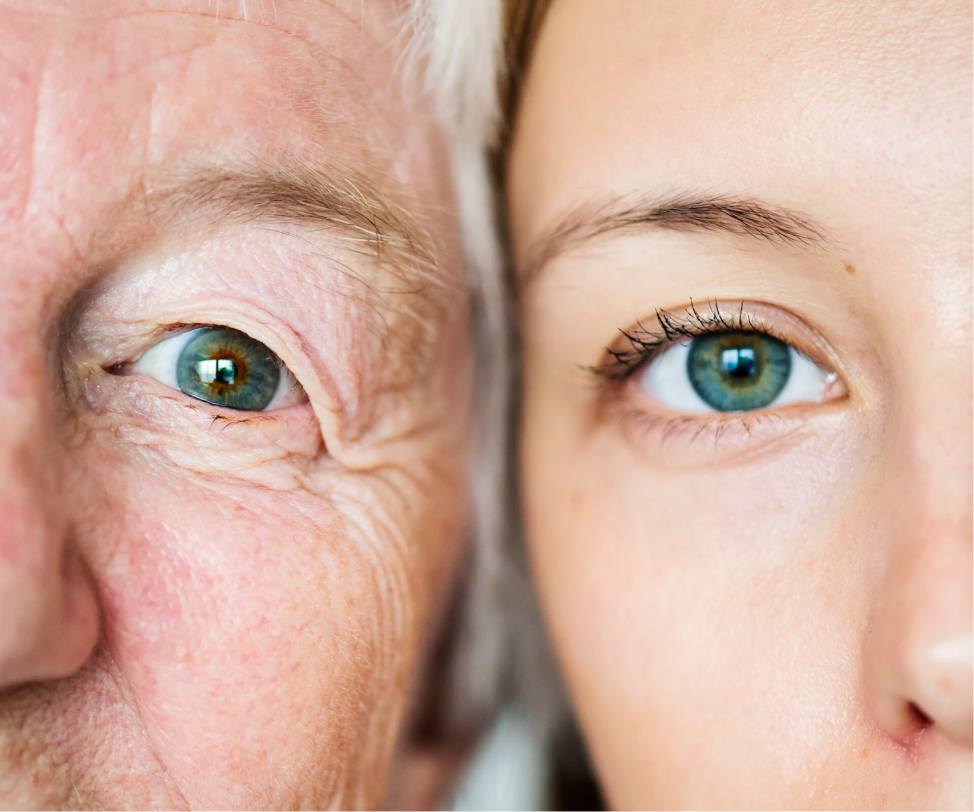 зрение возраст. пластика век. смена взгляда. изменение взгляда. возрастные изменения человека.