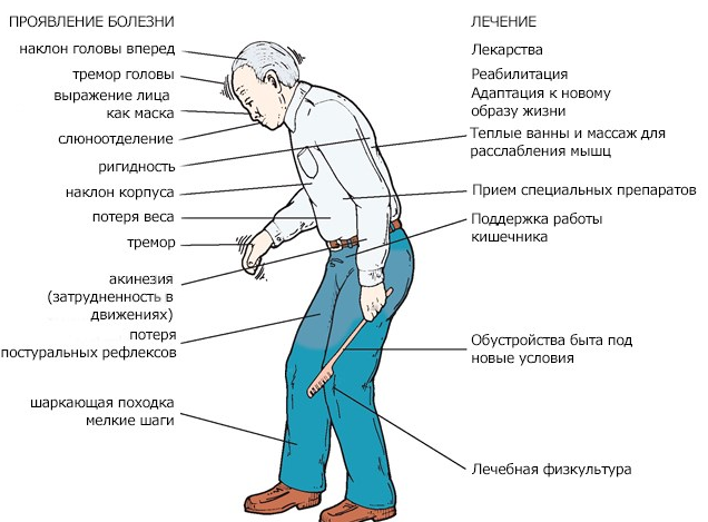 Вредные факторы при сварке и резке