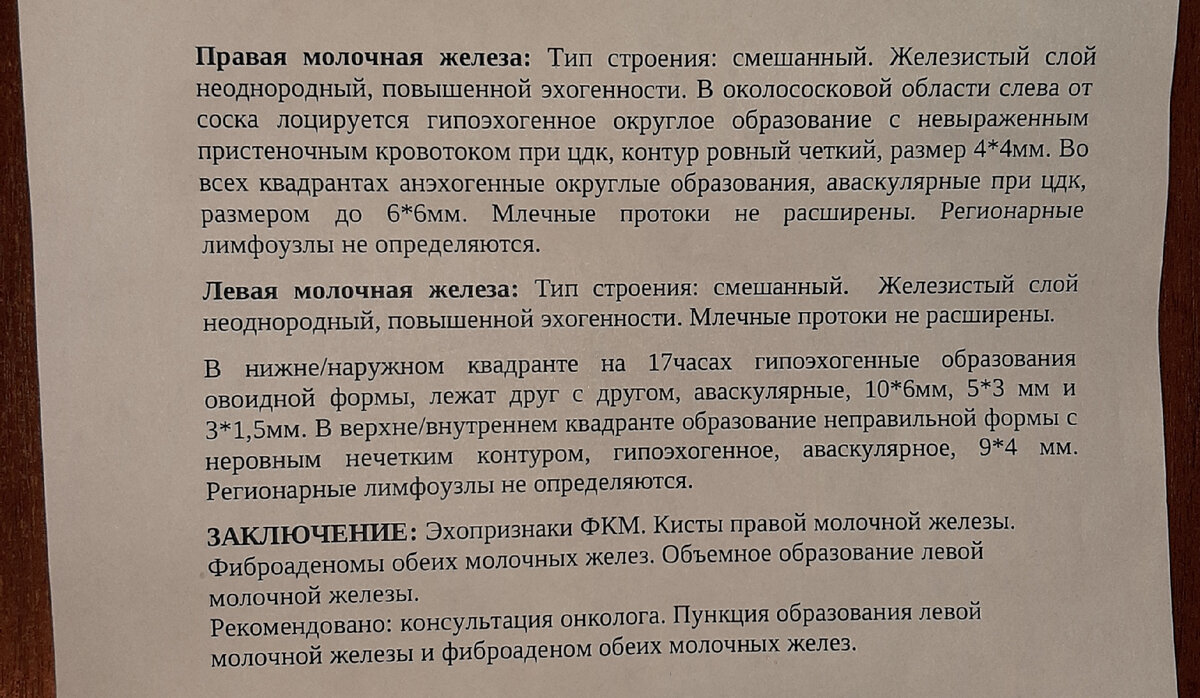 Внутропротоковая папиллома? Фиброаденома? Рак? Отзыв спустя 1,5 года после  операции по удалению внутрипротоковой папилломы. | Odarka_Dara | Дзен