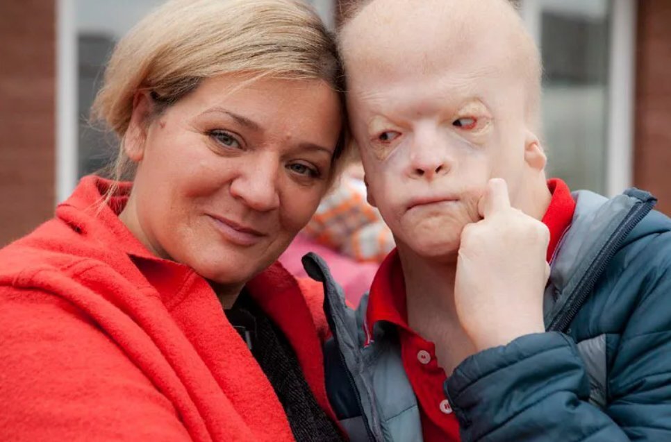 Как формируются воспоминания. Что за дети похожие на инопланетян. Что за дети похожие на инопланетян. Что за дети похожие на инопланетян. Что за дети похожие на инопланетян.