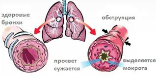 взято с общего доступа