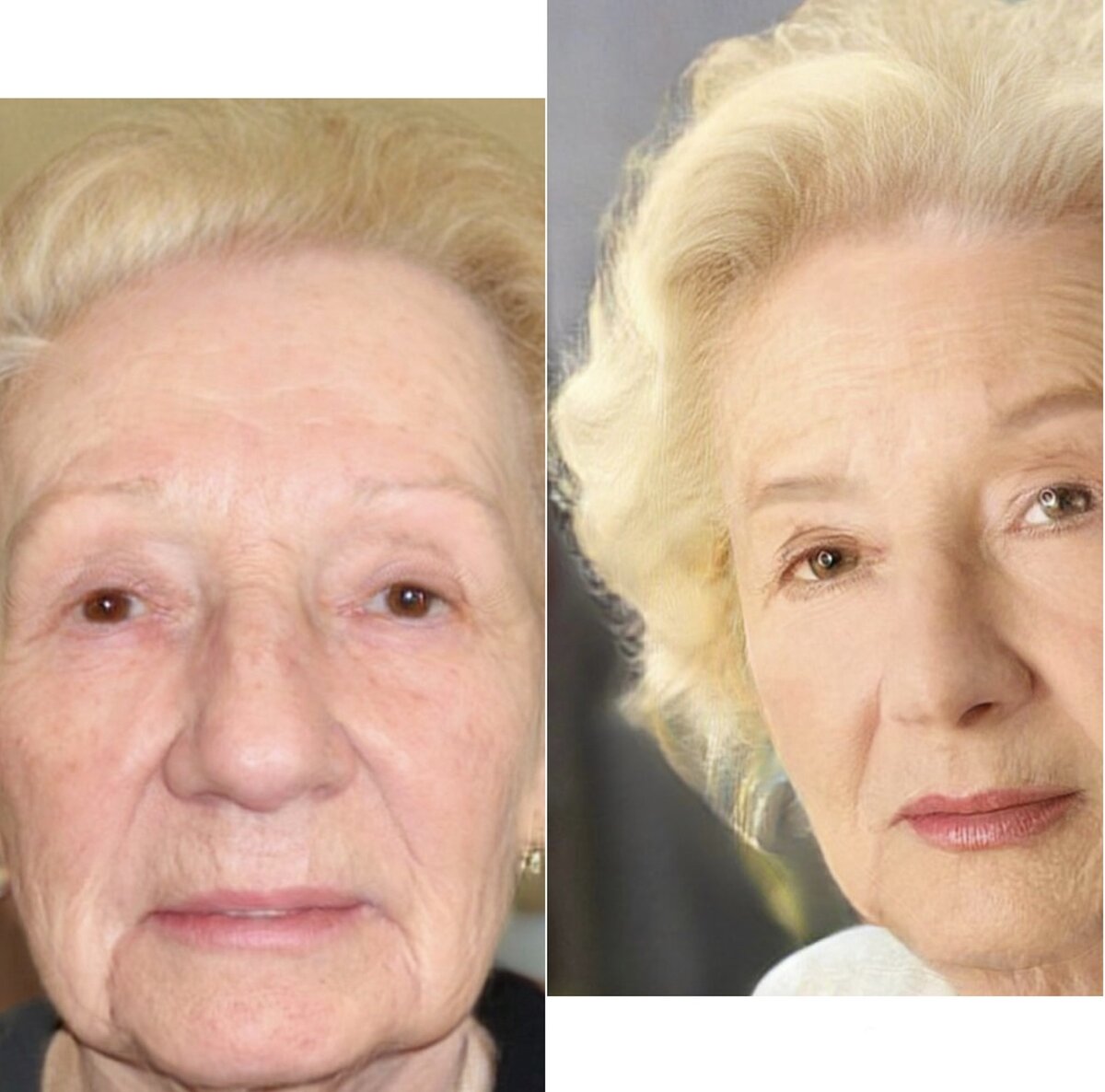 женщина с морщинами. просто омоложение. рестилайн носогубные складки. гимнастика для глаз. самомассаж лица.