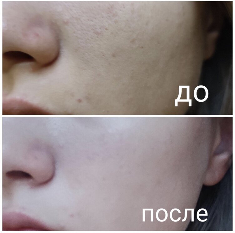 Артикул на Валдбериес: 77913745
