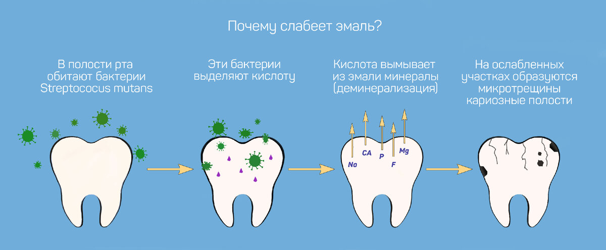Чёрные зубы: почему они темнеют и как с этим бороться?