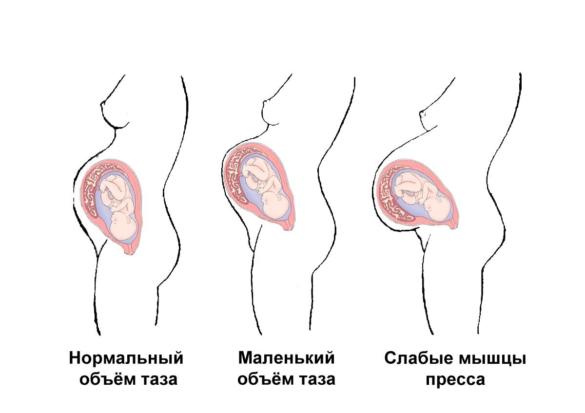 Размер живота во время беременности | Буду лучшей мамой с ФЭСТ | Дзен