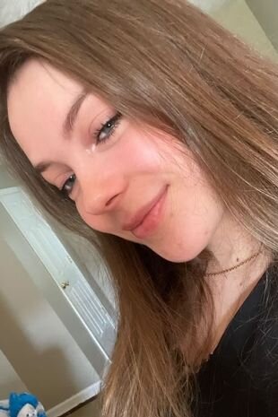 Эмма до процедуры 