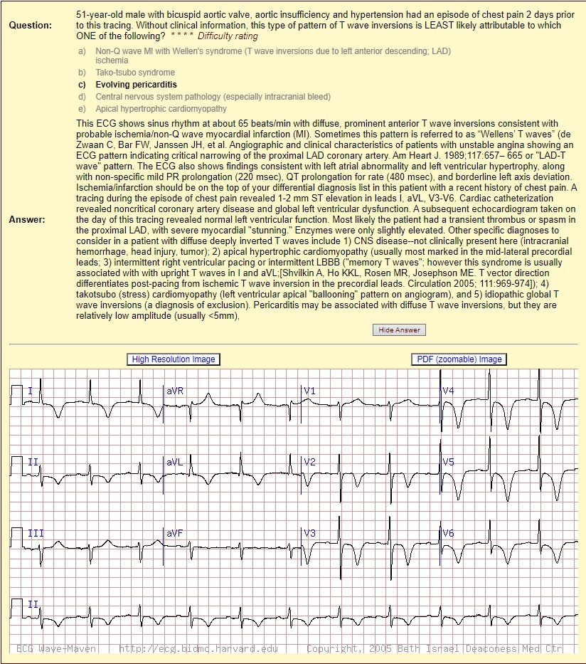 Все на английском. Но это плюс 1 повод поднатаскаться в медицинском английском.