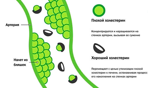 Будьте бдительны - следите за уровнем холестерина