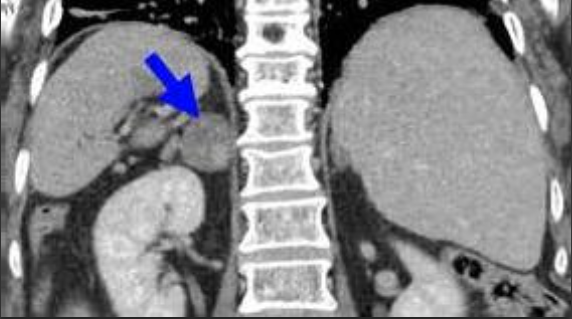 Снимок я нашёл в интернете ибо моего снимка нет уже очень давно